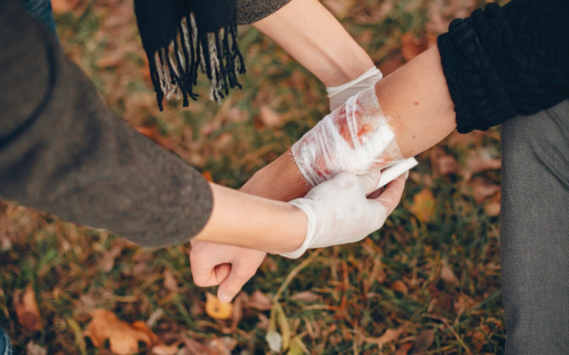 Yanık Tedavi ve Bakım Hizmetleri